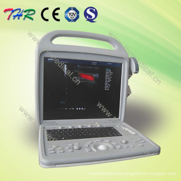 Portable Color Doppler Ultrasound Scanner (THR-CD580)